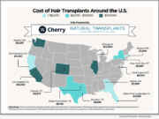 Natural Transplants in Ft. Launderdale, and Cherry, Release Exclusive 2026 Guide to Hair Transplant Cost in USA Cost of Hair Transplants Across the U.S. - Cherry and Natural Transplants