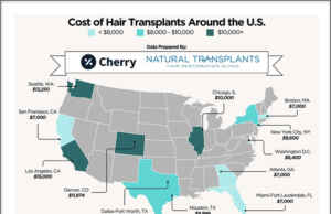 Natural Transplants in Ft. Launderdale, and Cherry, Release Exclusive 2026 Guide to Hair Transplant Cost in USA Cost of Hair Transplants Across the U.S. - Cherry and Natural Transplants